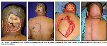 Según su composición.