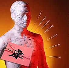 7000 BCE Medicina tradicional China (Acupuntura)