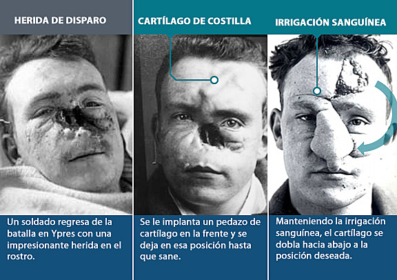 Primera Guerra Mundial