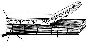 Patrones regionales de colgajos