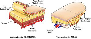 División de colgajos