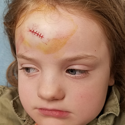 Baby's First Stitches