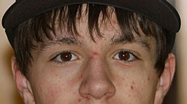 Timeline: American Revolution Timeline