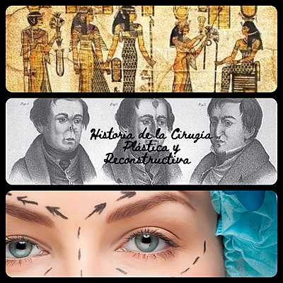 Timeline: Historia de la Cirugía Plástica y Reconstructiva