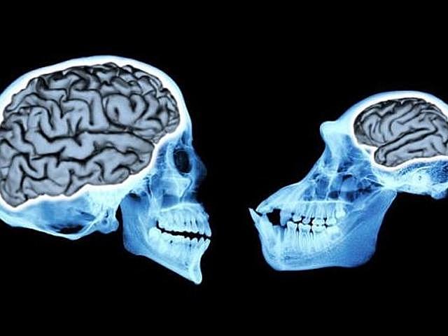 ¿Por qué surgió el cerebro?