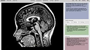 Francis Joseph Gall - Johann Casper Spurzheim