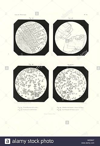 Alfred Donné y Léon Foucault