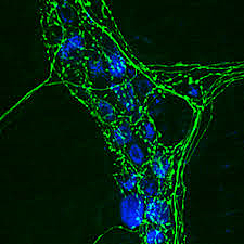 La empresa Carl Zeiss