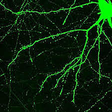 Otto Friedrich Dieters descubre las dendritas