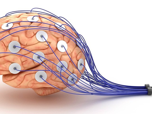 Electroencefalograma