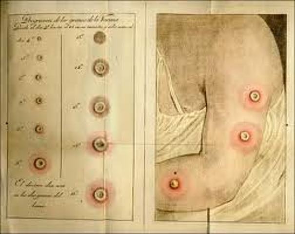 Inoculacion de Viruel