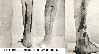 EXPERIMENTOS DE REGENERACIÓN Y TRASPLANTES DE HUESOS