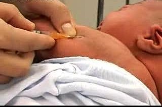 EXPERIMENTO PEDIÁTRICO CON LA VACUNA PARA LA TUBERCULOSIS