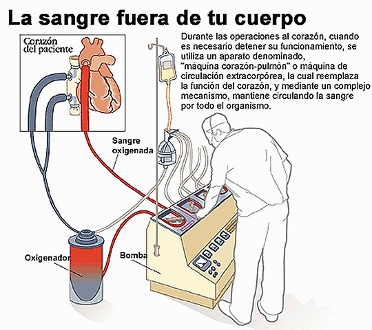 CIRCULACIÓN EXTRACORPOREA