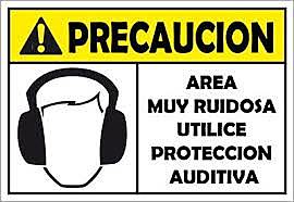 Exposición Auditiva