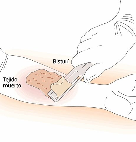 Tratamientos para perdida de piel