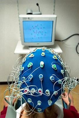 Electroencefalografía (EEG)