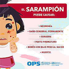 Sarampion - la erradicación del sarampión es una meta factible