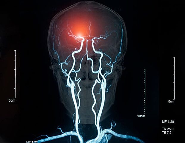 Ley de la Conservación de la Energía