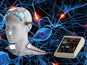 Estimulación Eléctrica  SNC