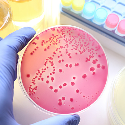 Timeline: Linea de tiempo Historia de la microbiologia