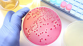 Timeline: Linea de tiempo Historia de la microbiologia