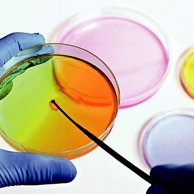 Timeline: HISTORIA DE LA MICROBIOLOGIA