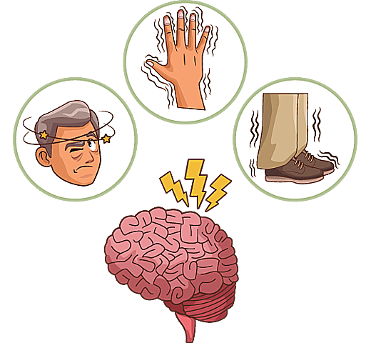 PARÁLISIS TREPIDANTE