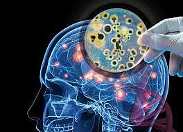 Se describio la mayoría de los síndromes neuropsicológicos