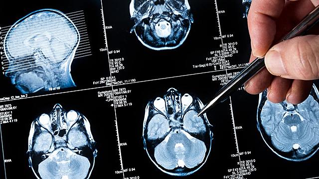 Era de las imágenes cerebrales