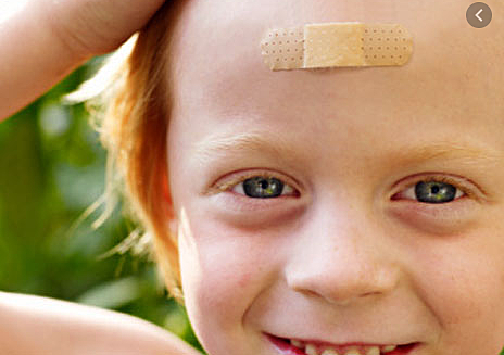 rock cut my forehead.