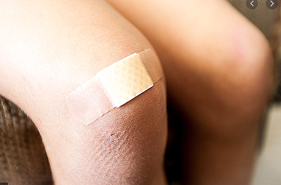 my birthday party/the time i got the scar on my knee.