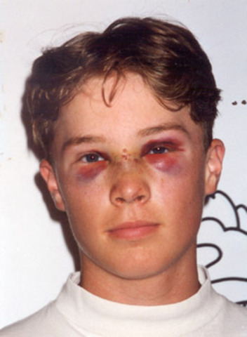 got beat up by kieran