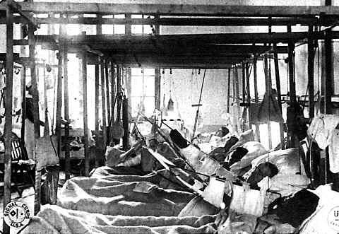 Grandes perdidas demográficas y materiales