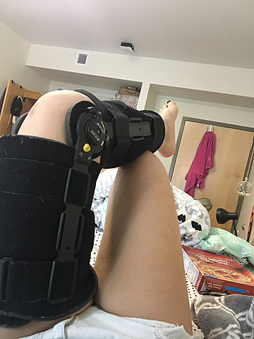 Tore my ACL for a third time