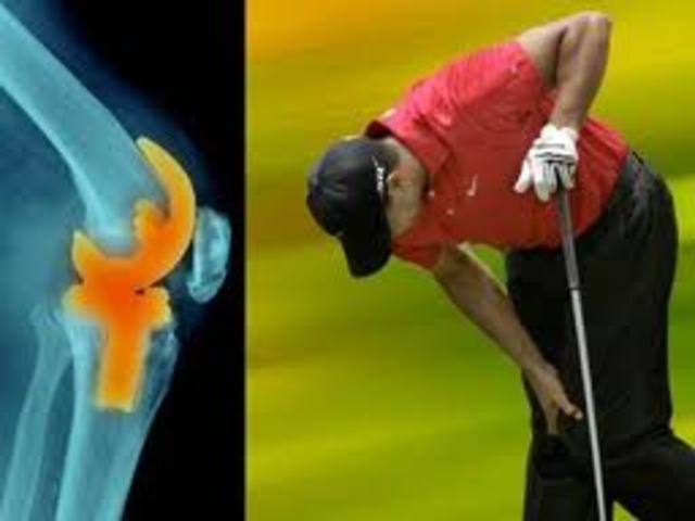 Tiger Woods undergoes major surgery on his knee.