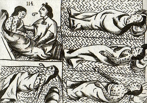 the Aztec get smallpox