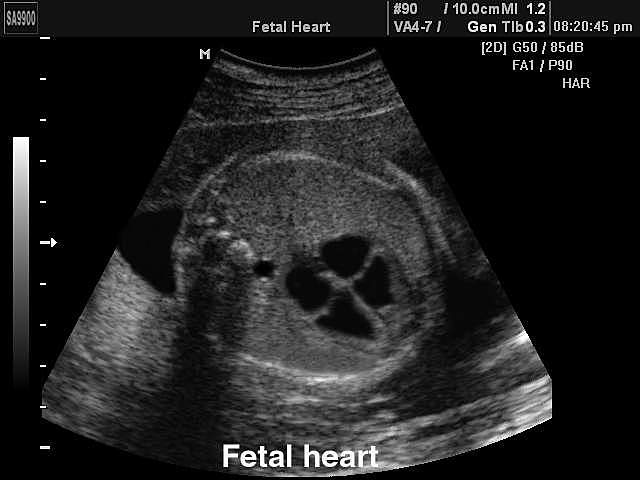 PRENATAL-Heart(physical)
