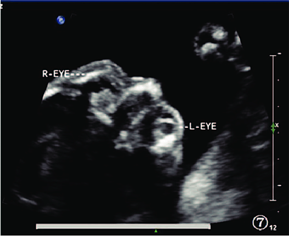 PRENATAL-Eyes(Physical)