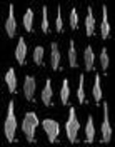 Streptoghathodus Zethus