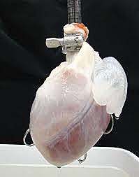 TRASPLANTE DE ÓRGANO SINTÉTICO