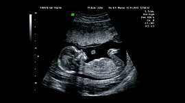 Timeline: Prenatal Timeline