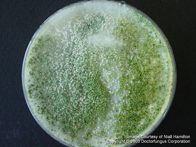 Cepas de hongos fitopatógenos resistentes a fungicidas