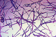 Louis Pasteur desarrolla una vacuna contra el ántrax .