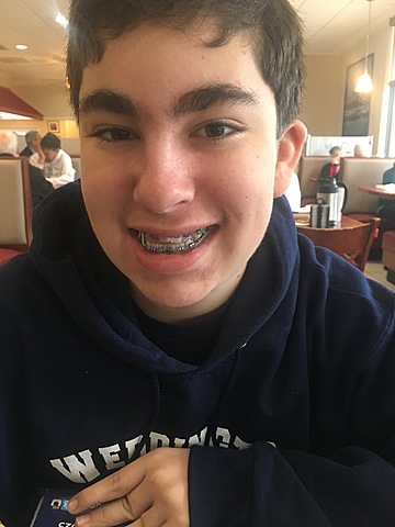 Me pusieron frenillos