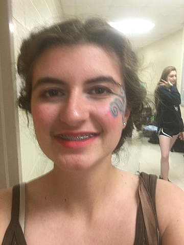 Me pusieron frenillos