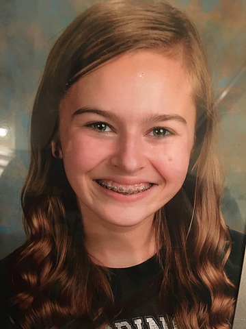 Me pusieron frenillos.