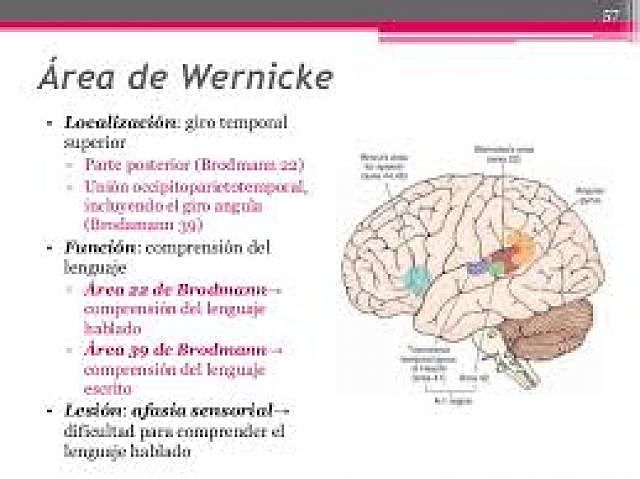 Wernicke