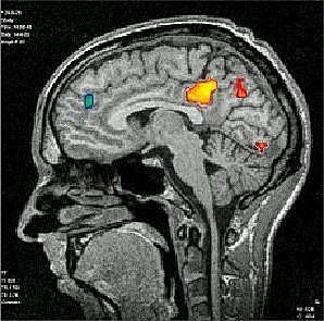 Arvid Carlsson, Paul Greengard y Eric Kandel