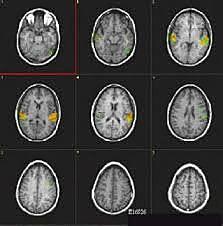 Segi Ogawa u colegas
